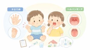 【医療コラム】「手足口病とヘルパンギーナの違い」を解説しました